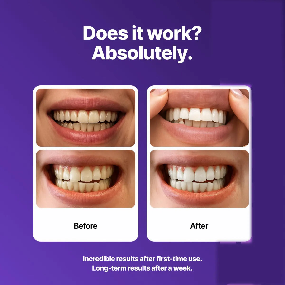 Teeth Whitening Strips for Yellow Teeth